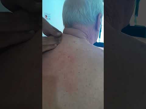 Mr. Noom, Nerve Massage 084/3621714 388/6 Soi Kopai in Pattaya. The long road to recovery